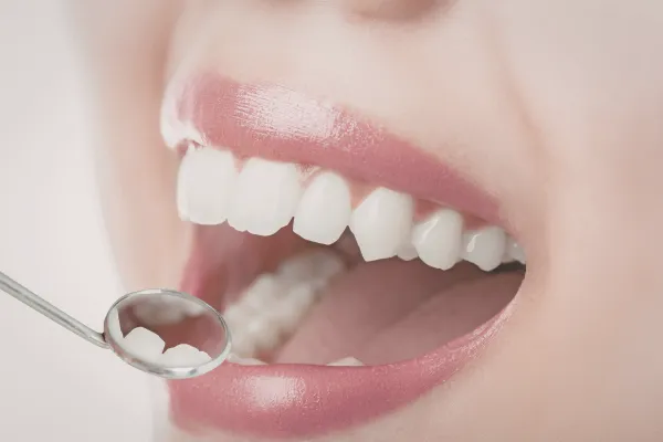 歯科検診のイメージ