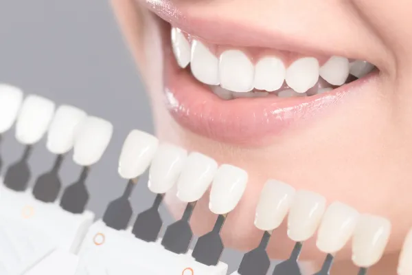 ホワイトニングのイメージ